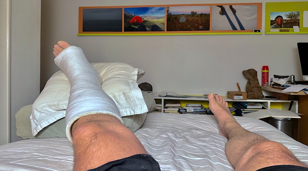 A cast is much more of an impediment to mobility than you might imagine. | Back in Nelson
