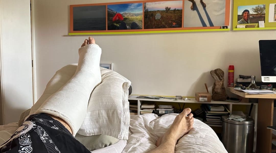 Keep that Achilles tear elevated. Just two weeks too late. | Achilles tear