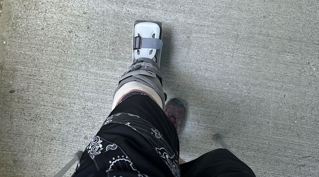 Moonboot beats a cast, for sure. It's weight-bearing. | Nelson January 2024
